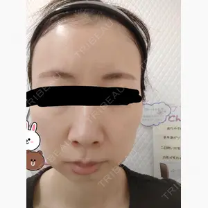 椿クリニック 名古屋院口コミ