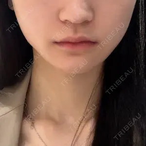 博多美容外科/美容皮膚科 ビラビューティークリニック口コミ
