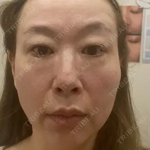 藤・ナチュレ美容クリニック 銀座院口コミ