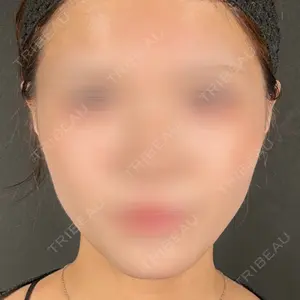 R Beauty CLINIC 名古屋院口コミ