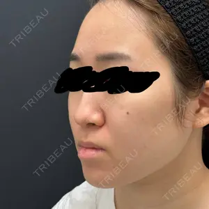 ルラ美容クリニック 広島院口コミ