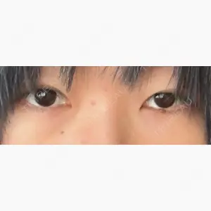 HAAB×DREAM BEAUTY CLINIC 東京本院口コミ