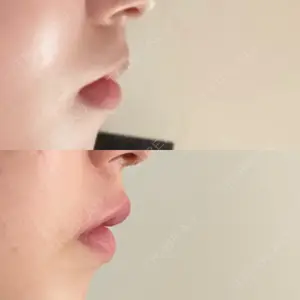 PRO CLINIC プロクリニック 銀座院口コミ