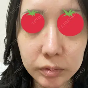 ルラ美容クリニック 郡山院口コミ