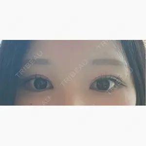 HAAB×DREAM BEAUTY CLINIC 東京本院口コミ