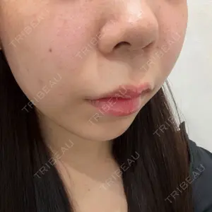 ゼノクリニック口コミ