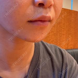 LOUIS CLINIC 二子玉川院【ルイクリニック】口コミ