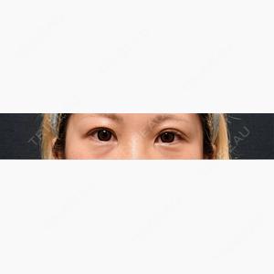 Glowa Clinic口コミ