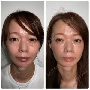 神戸美容外科 ネビュラクリニック口コミ