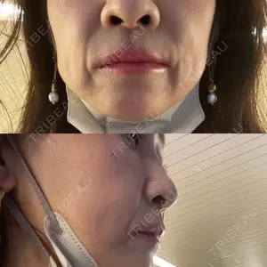 HAAB×DREAM BEAUTY CLINIC 大阪梅田院口コミ