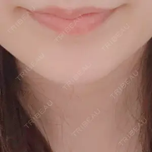 白金ビークリニック 本院口コミ