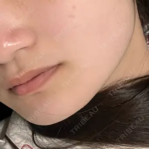 東京美容皮膚科アロエクリニック池袋東口院口コミ