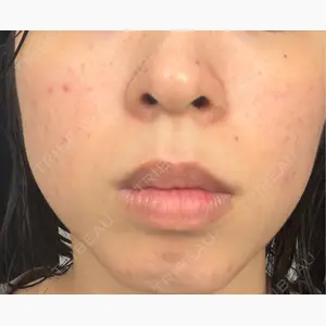 HAAB×DREAM BEAUTY CLINIC 東京本院口コミ