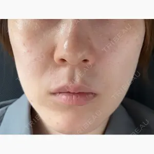 NARU SKIN Beauty Clinic口コミ