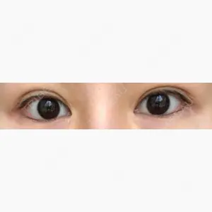 オペラ整形外科口コミ