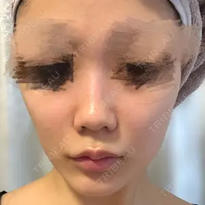 プリモ麻布十番クリニック口コミ