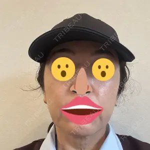 グナル美容外科梅田院口コミ