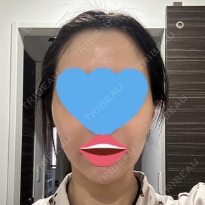 TCB東京中央美容外科 柏院口コミ