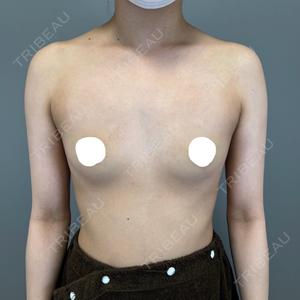 BELINDA CLINIC（ベリンダクリニック）新宿院口コミ