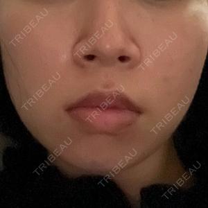 グローバルビューティークリニック 大阪院口コミ
