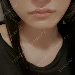 Tokyo Tensei Clinic 新宿院口コミ