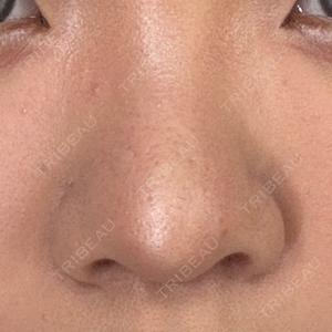 NARU Beauty Clinic 【ナルクリ】 水戸院口コミ