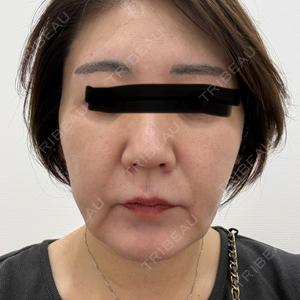 東京シンデレラ美容外科 池袋院口コミ