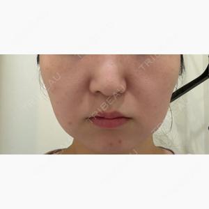 ライズワン美容皮膚科クリニック口コミ