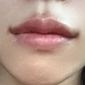 ルラ美容クリニック 千葉院 / ルラスキンクリニック 千葉院口コミ