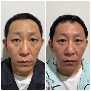 神戸美容外科 ネビュラクリニック口コミ