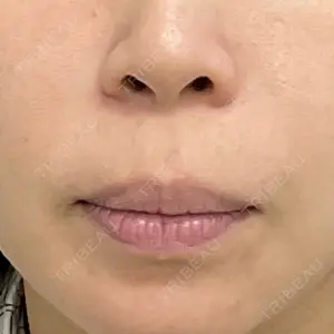 ガーデンクリニック 大阪院口コミ