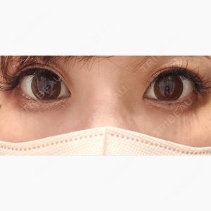湘南美容クリニック 札幌院口コミ