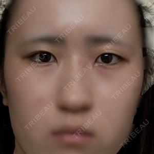 HAAB×DREAM BEAUTY CLINIC 東京本院口コミ