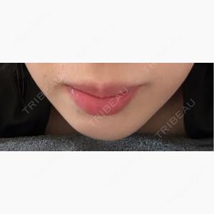 あいちビューティークリニック栄本院口コミ