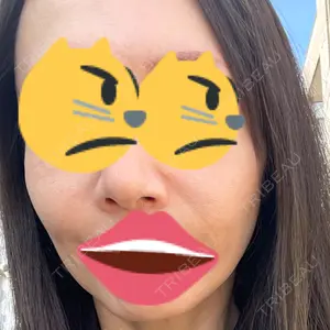 TCB東京中央美容外科 広島院口コミ
