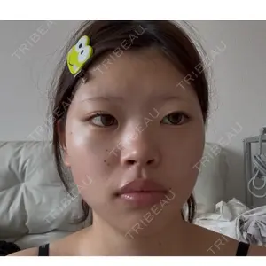 R Beauty CLINIC 銀座院口コミ