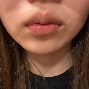 TCB東京中央美容外科 藤沢院口コミ