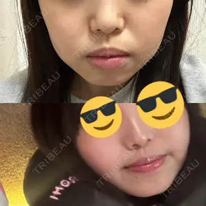 R Beauty CLINIC 銀座院口コミ