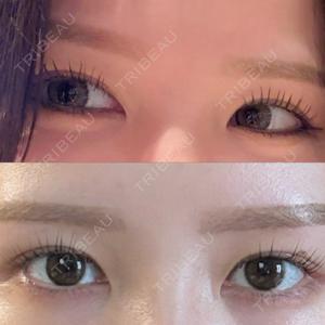 東京シンデレラ美容外科 大宮院口コミ