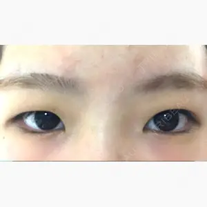 きくな湯田眼科口コミ