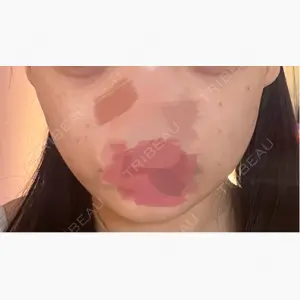 名古屋美容外科口コミ