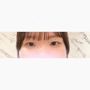 HAAB×DREAM BEAUTY CLINIC 大阪梅田院口コミ