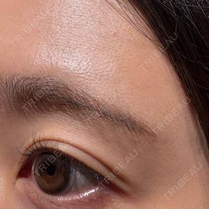 聖心美容クリニック 大宮院口コミ