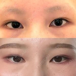 東京シンデレラ美容外科 大宮院口コミ