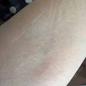 DAILY SKIN CLINIC 福岡院口コミ