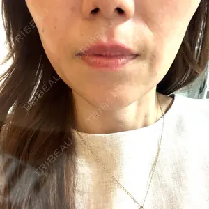 名古屋美容外科口コミ
