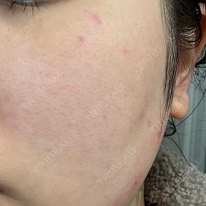 東京シルククリニック 東京神田院口コミ