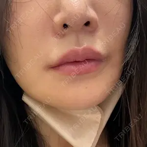 ゼノクリニック口コミ