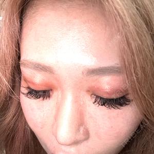 新宿美容外科ネビュラクリニック口コミ