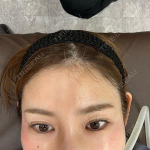 TCB東京中央美容外科 姫路院口コミ